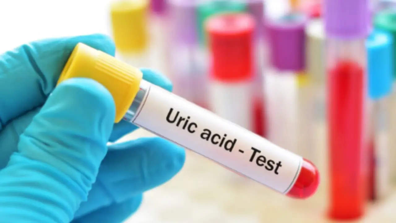 Come ridurre i livelli di acido urico con la dieta